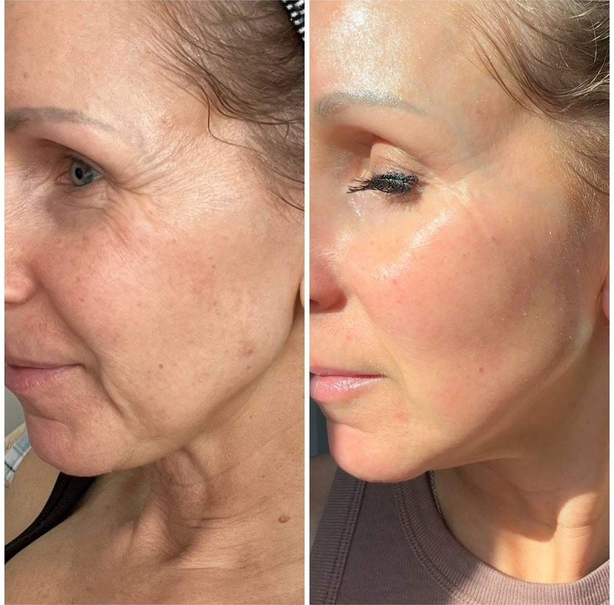 LumiGlow™ 7 in 1 Led Mask