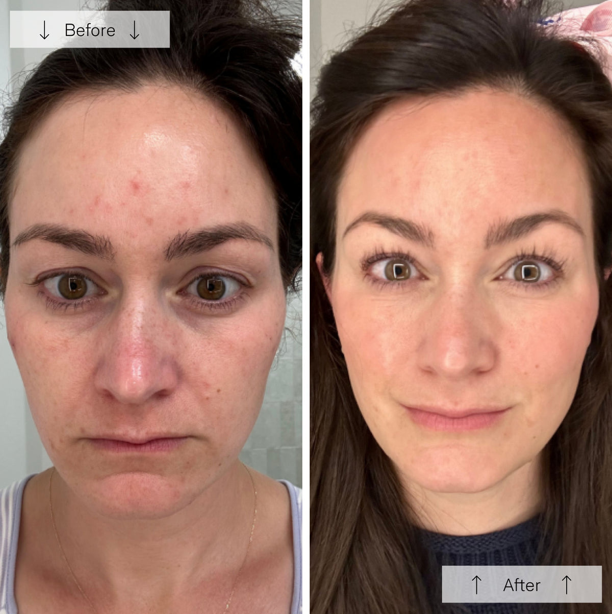 LumiGlow™ 7 in 1 Led Mask